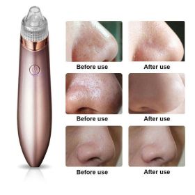 Electric Blackhead Vacuum Pore Cleaner Acne Pimple Remover Strong Suction Tool Electric Blackhead Remover Pore Vacuum Suction Diamond Dermabrasion Fac