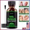 ANTI FUNGAL TREATMENT EXTRA STRENGTH TOENAIL FUNGUS ATHLETES FOOT FUNGI NAIL