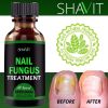 ANTI FUNGAL TREATMENT EXTRA STRENGTH TOENAIL FUNGUS ATHLETES FOOT FUNGI NAIL